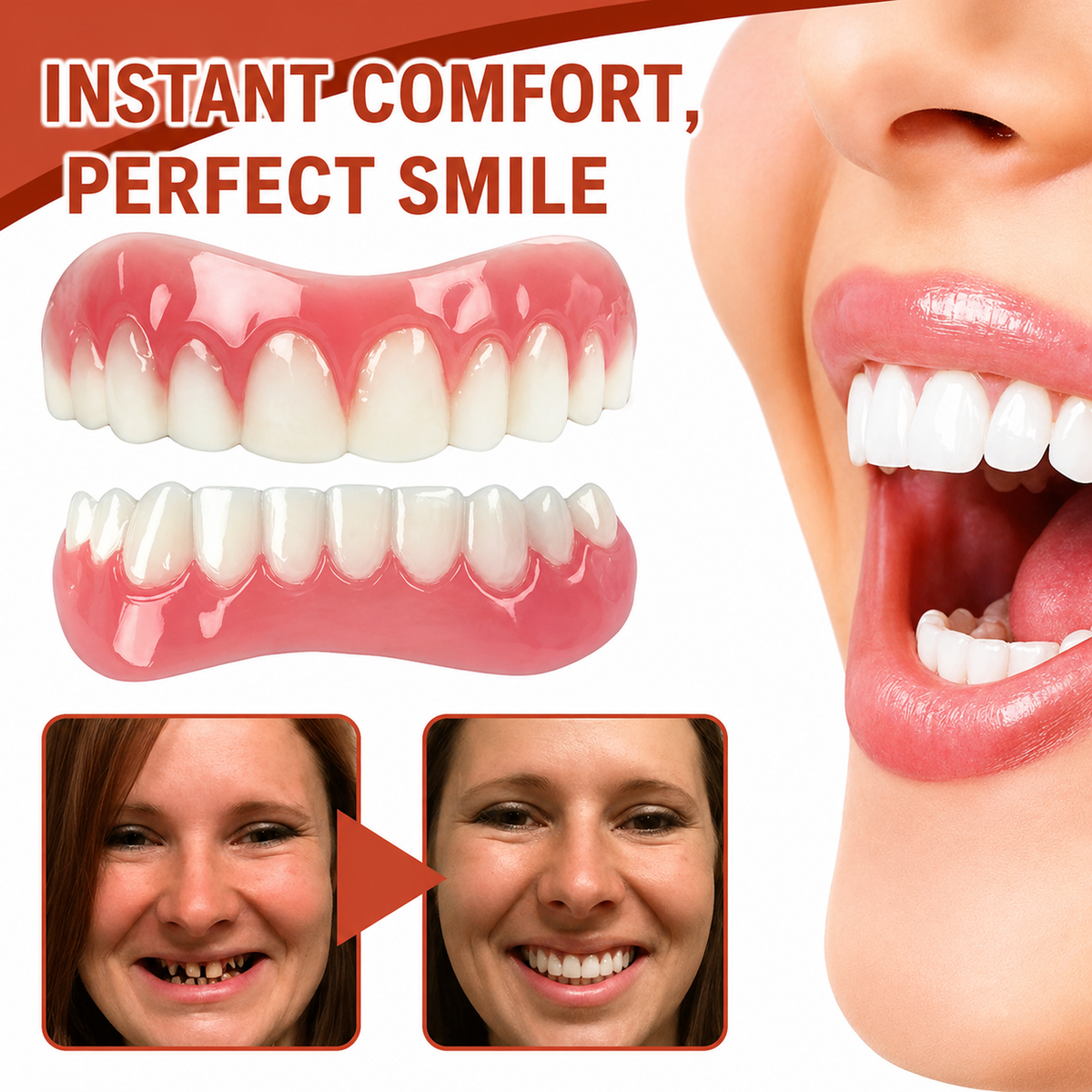 Snap on Veneers with Moldable Backing and Customizable Fit for Upper Lower Teeth - Image 1