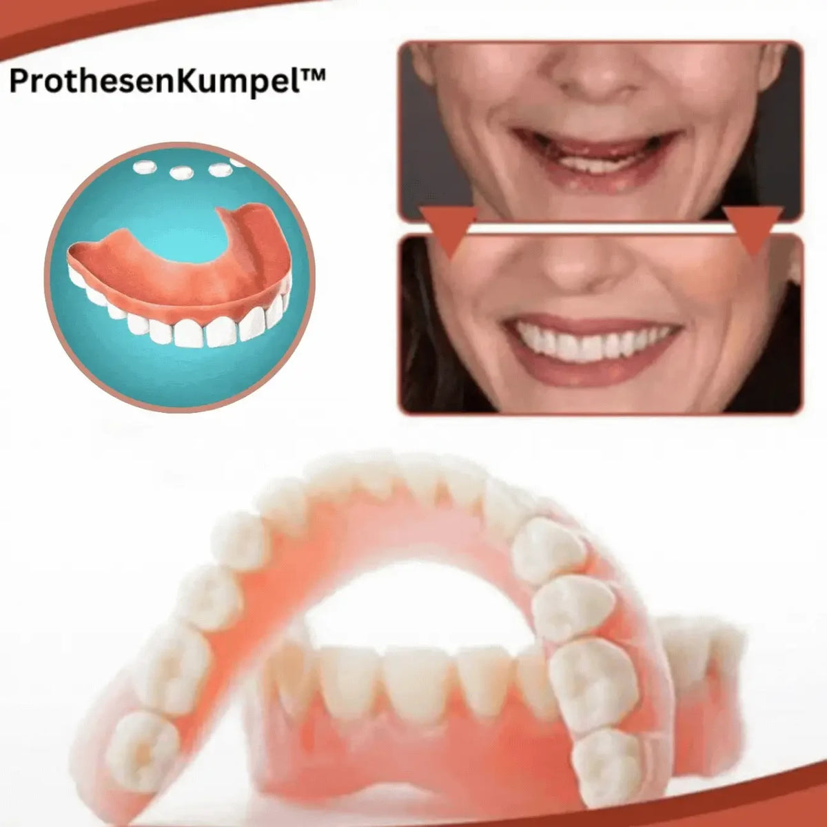 Snap on Veneers with Moldable Beads and Custom Fit Cosmetic False Teeth - Image 4