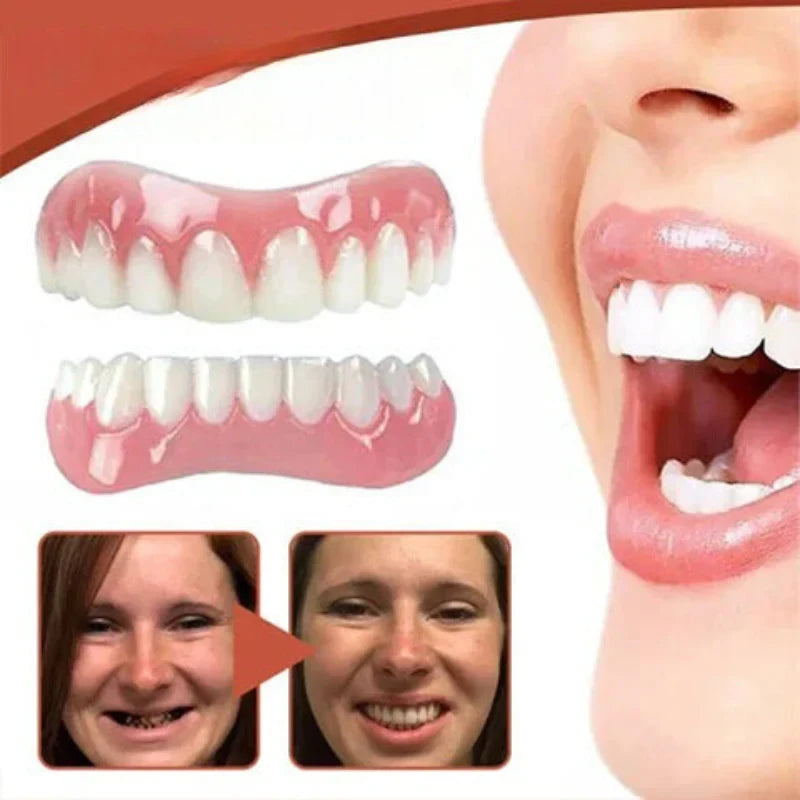 Snap on Veneers with Moldable Beads and Custom Fit False Teeth - Image 4